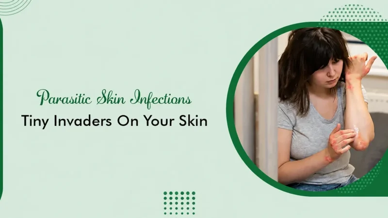 Parasitic Skin Infections- Tiny Invaders on Your Skin